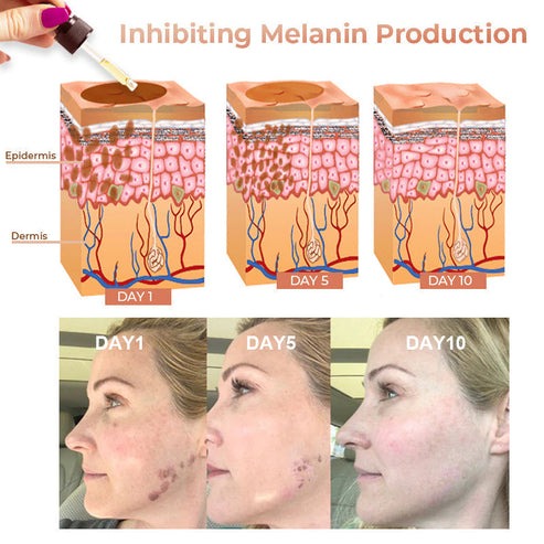 Skin Melanin Correcting Facial Serum