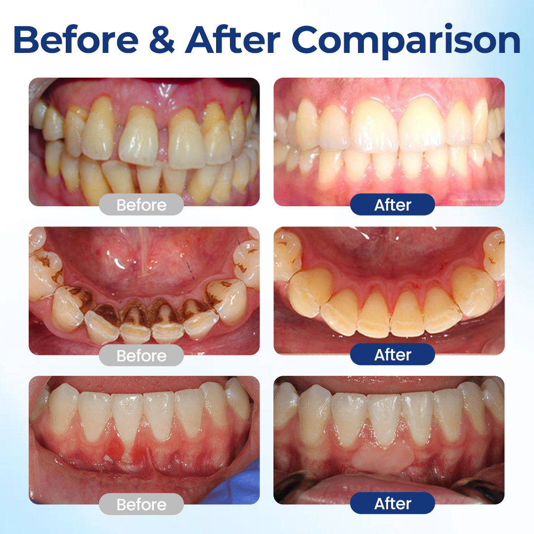 Tiworld® Oral Repair Solution
