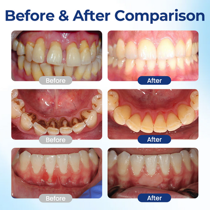 Tiworld® Oral Repair Solution