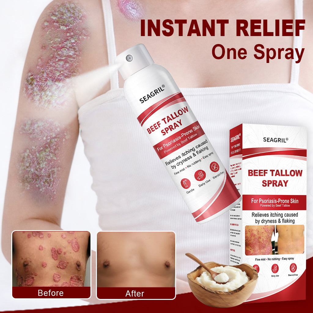 SEAGRIL® Beef Tallow Spray for Itchy, Flaky Psoriasis Skin 1