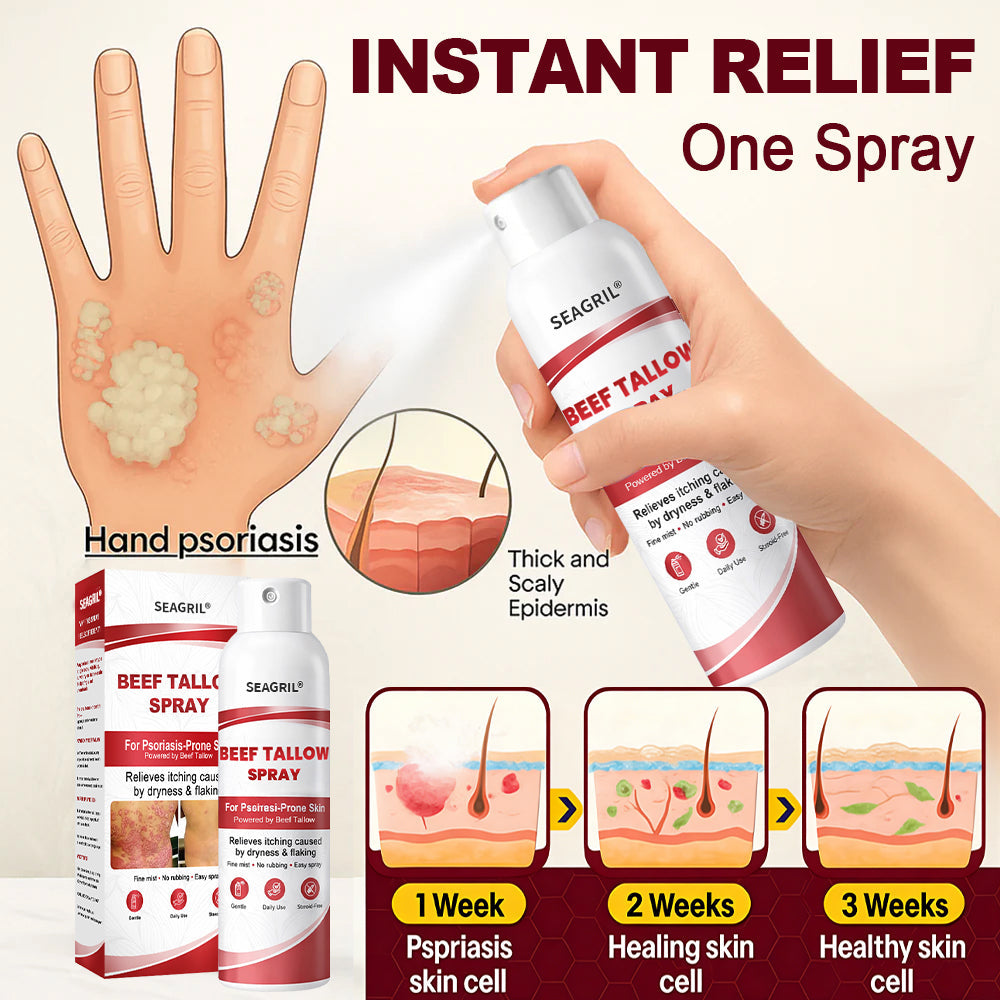 SEAGRIL® Beef Tallow Spray for Itchy, Flaky Psoriasis Skin 1