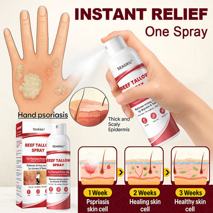 SEAGRIL® Beef Tallow Spray for Itchy, Flaky Psoriasis Skin 1