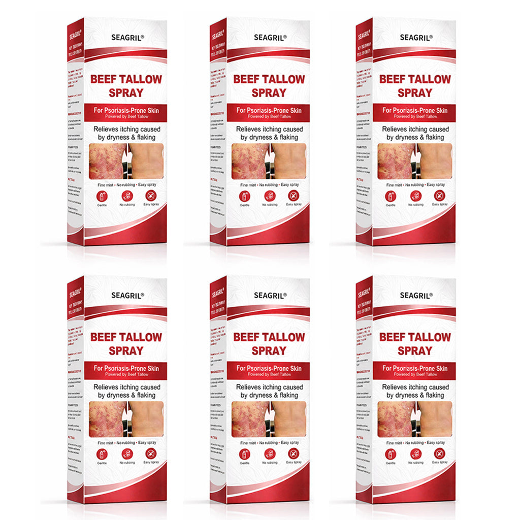 SEAGRIL® Beef Tallow Spray for Itchy, Flaky Psoriasis Skin 1