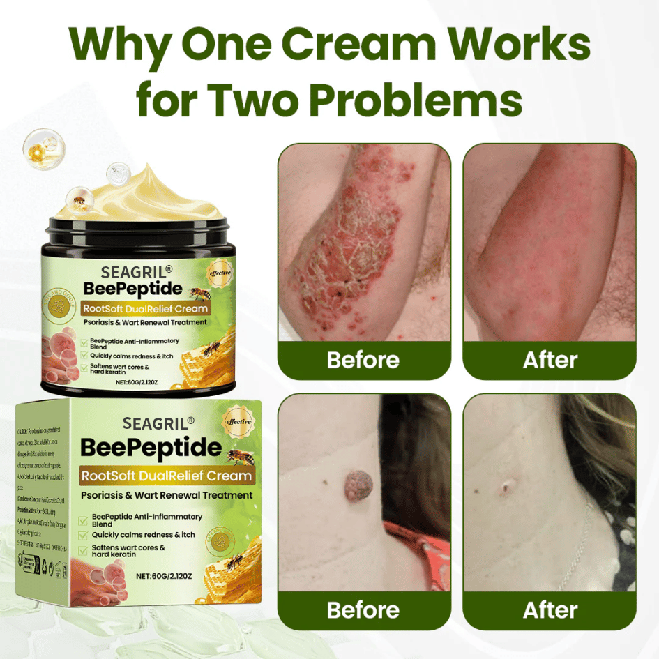 ✅SEAGRIL® BeePeptide RootSoft DualRelief Cream⚕️ ( Buy 1 Get 1 Free)