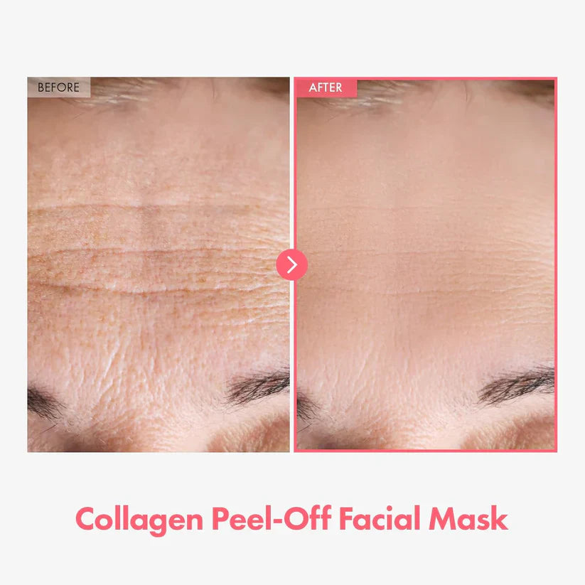 💥Limited Time Sales - 50% OFF💥Arbutin 7% + Tranexamic Acid 4% Cream