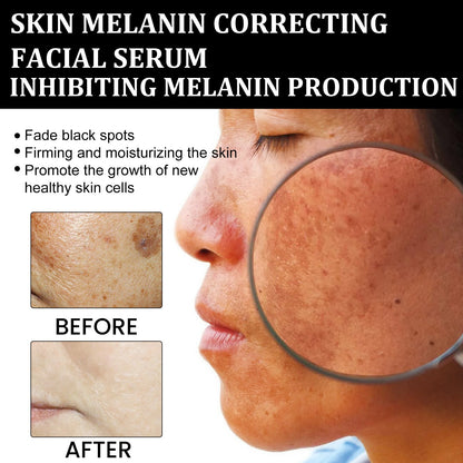 Skin Melanin Correcting Facial Serum